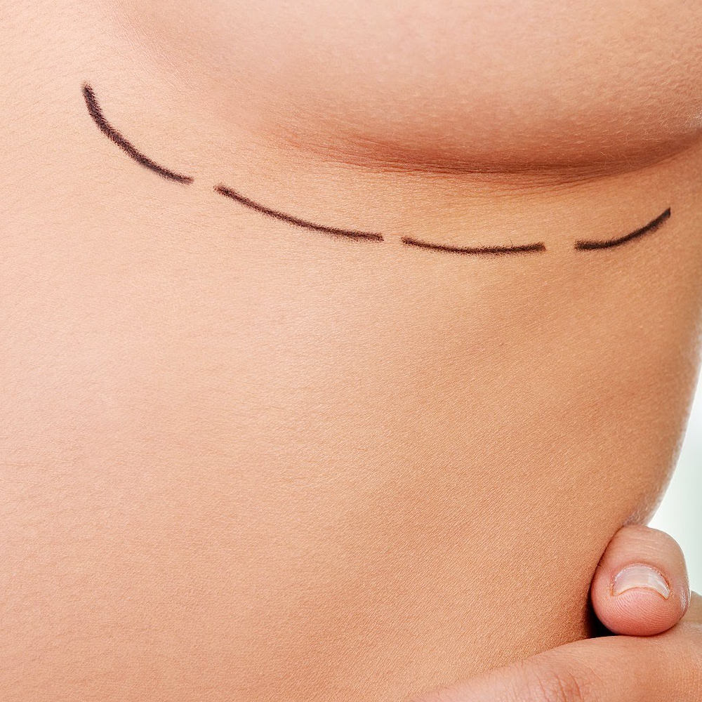 Siero Seno Rassodante Plus 